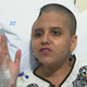 Illustration for article titled Surgeons In Brazil Successfully Implant A 3D-Printed Titanium Skull